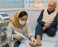 پلاسما تراپي درمان زخم ها شاخص